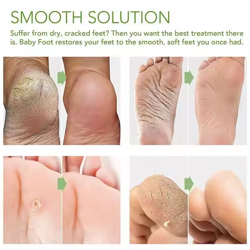 Exfoliating Foot Mask