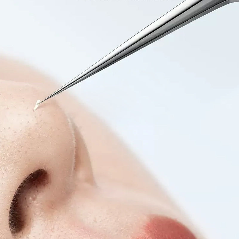 Blackhead & Pimple Removal Tool - Deep Cleansing