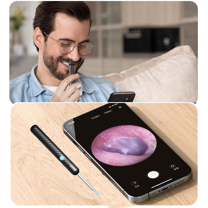 Ear Wax Removal Tool with 1080P Ear Camera and 6 Light