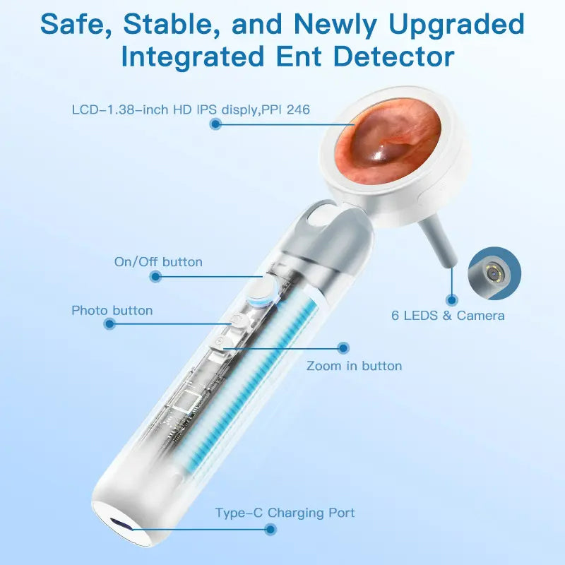 Ear Nose Mouth Scope with 1080P HD Camera