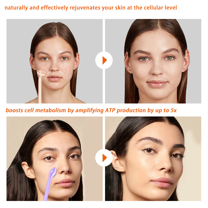 Portable Skin Therapy Machine with 6 Neon & Argon Wands