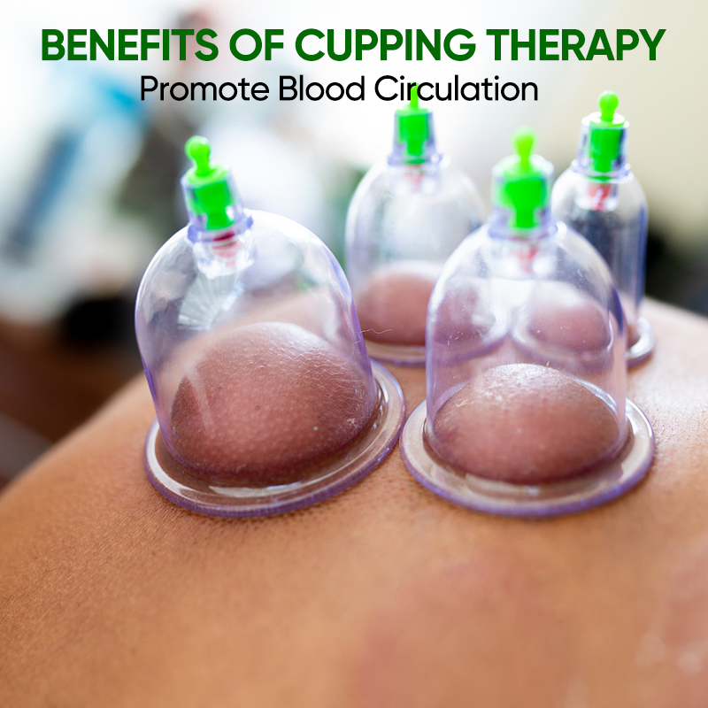 Cupping Set For Massage Therapy