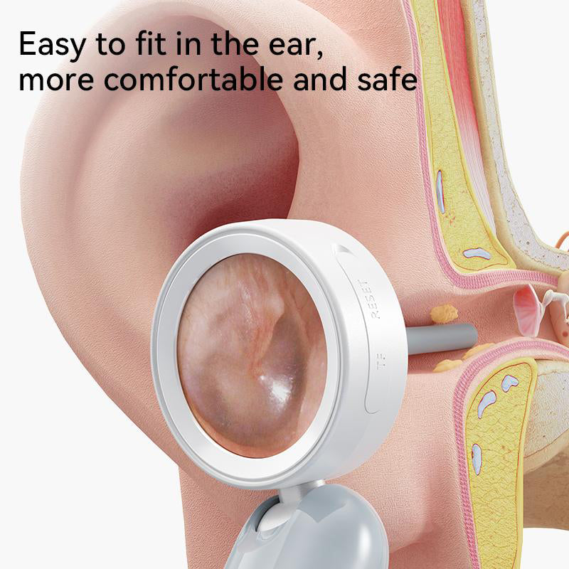 Ear Nose Mouth Scope with 1080P HD Camera