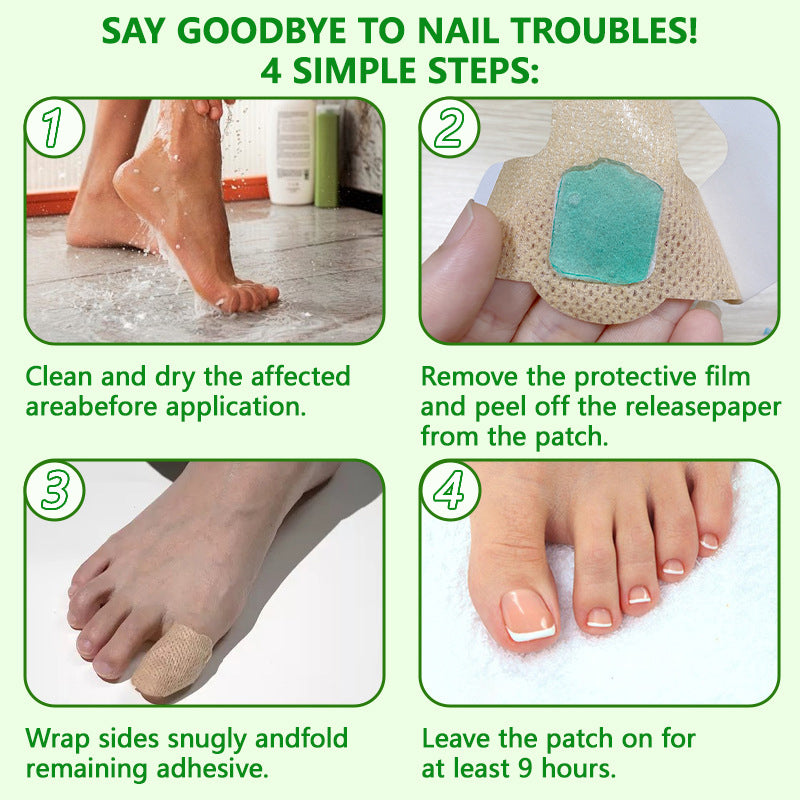 Fungal Nail Patches (21 pcs/box)