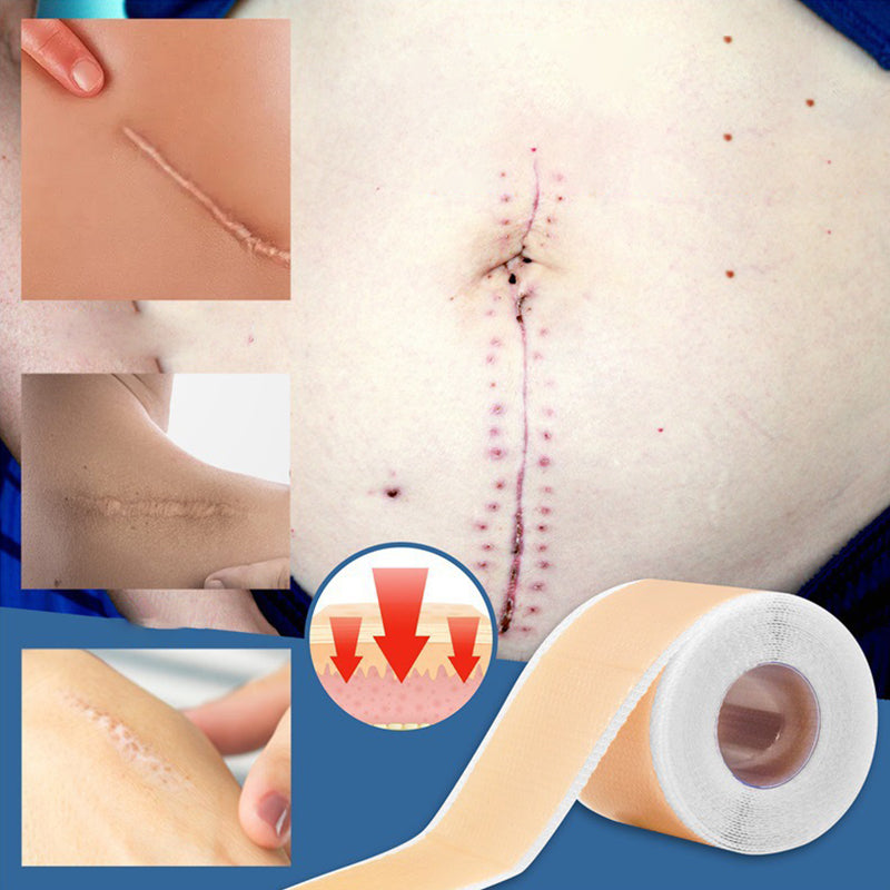 Silicone Wound Decrease Scar Patches