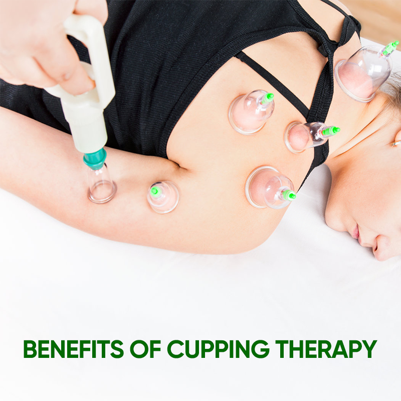 Cupping Set For Massage Therapy