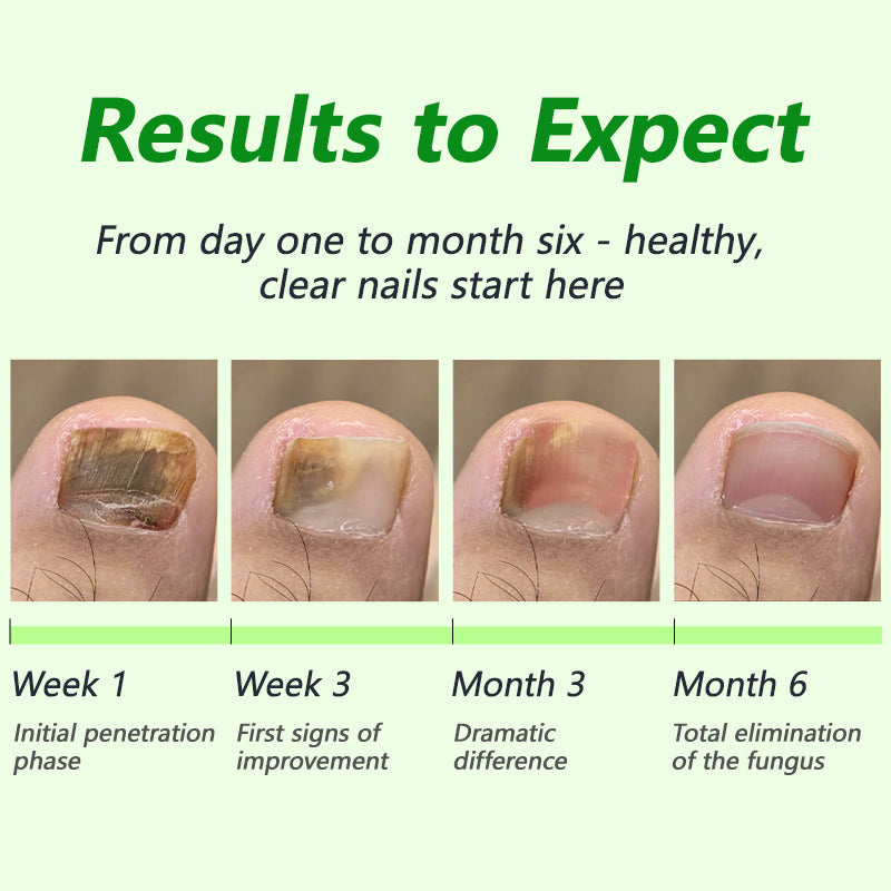 Fungal Nail Patches (21 pcs/box)