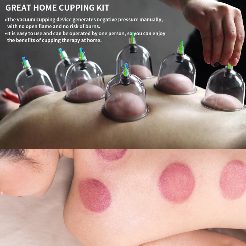 Cupping Set For Massage Therapy