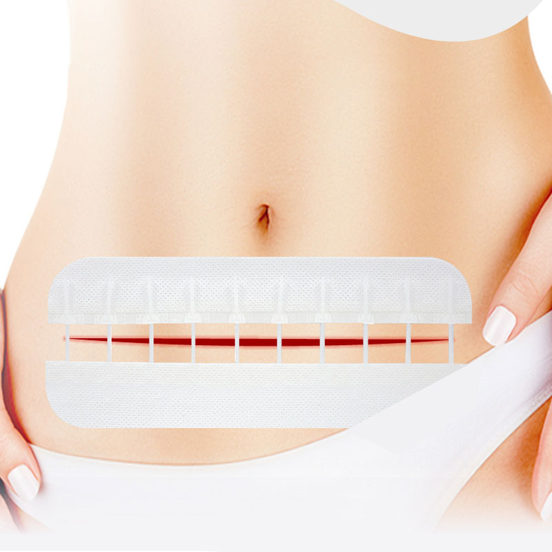 Emergency Wound Closure Strips