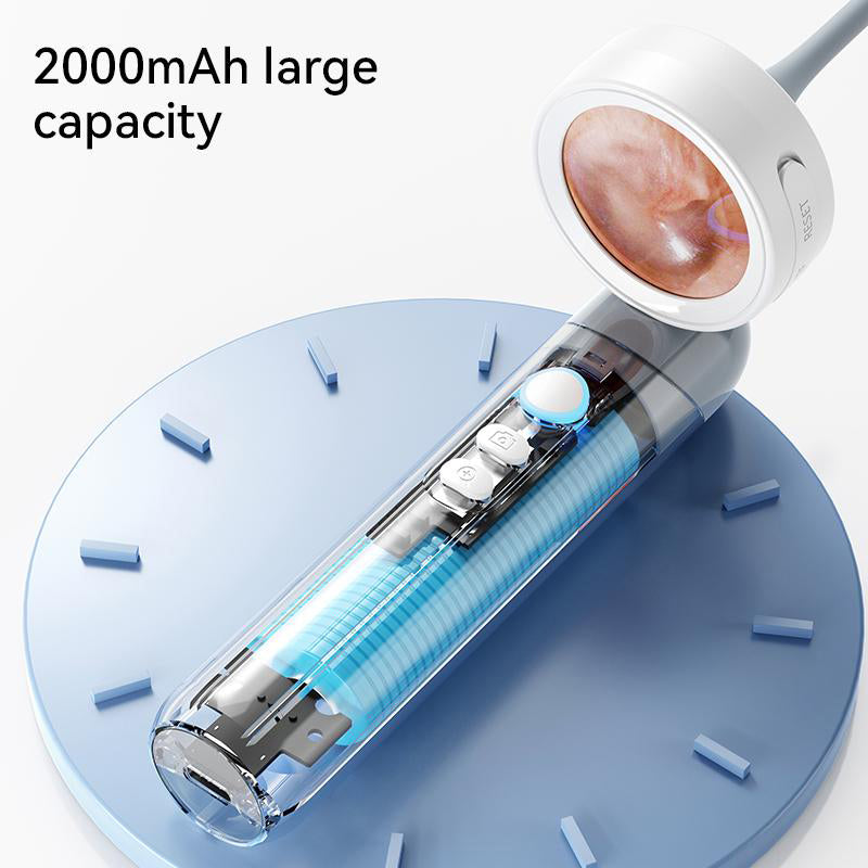 Ear Nose Mouth Scope with 1080P HD Camera