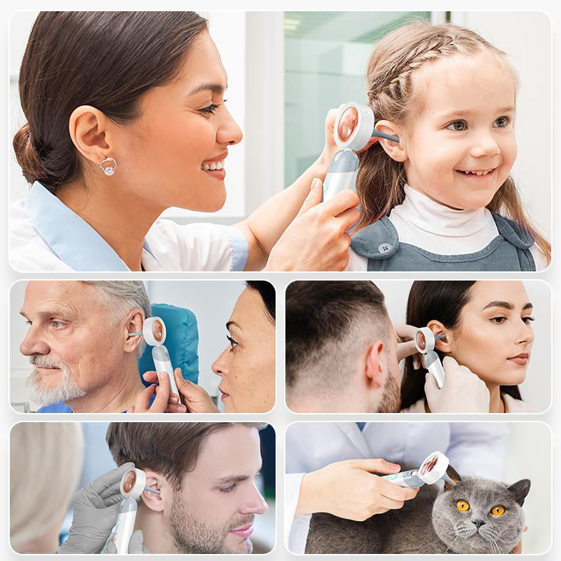 Ear Nose Mouth Scope with 1080P HD Camera