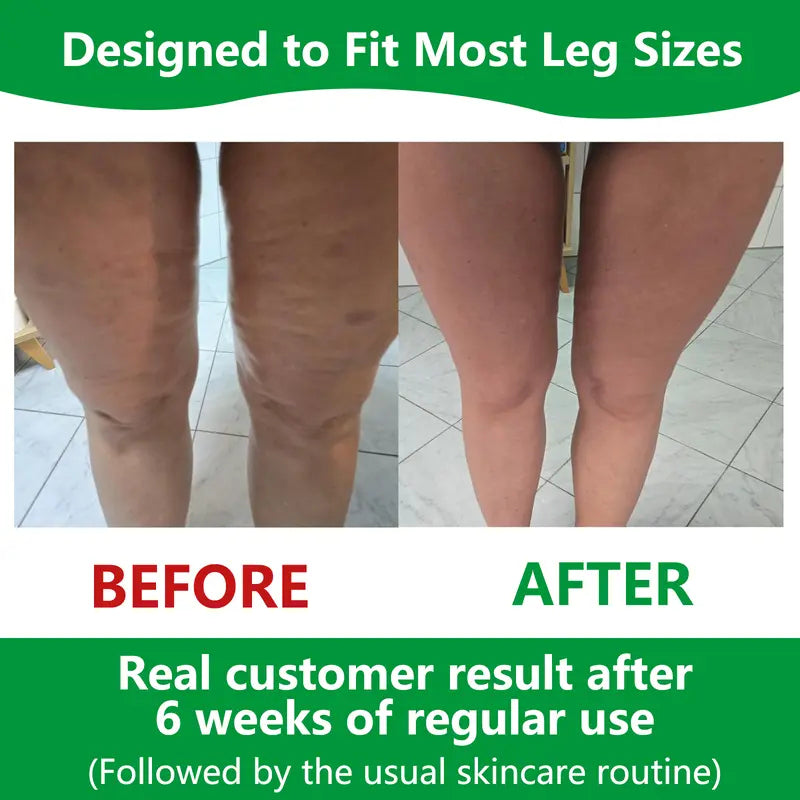 Cellulite Massage Roller