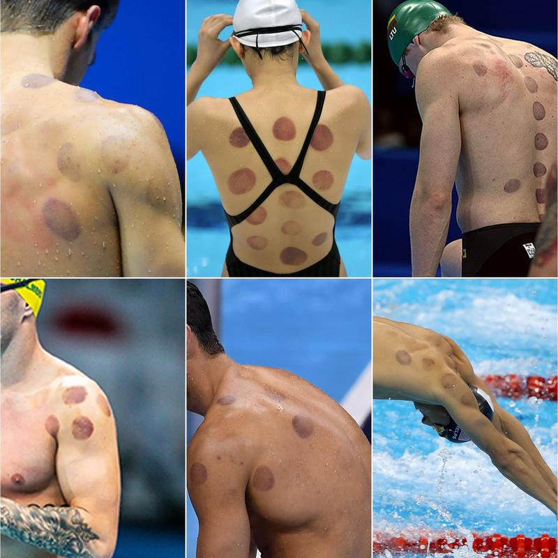 Cupping Set For Massage Therapy