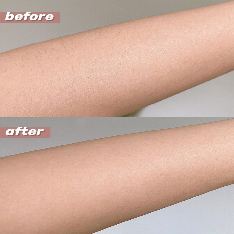 Rechargeable 2-in-1 Body and Facial Epilator