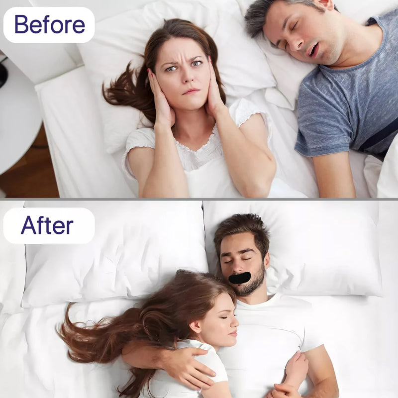 Elastic Anti-Snoring Mouth Tape