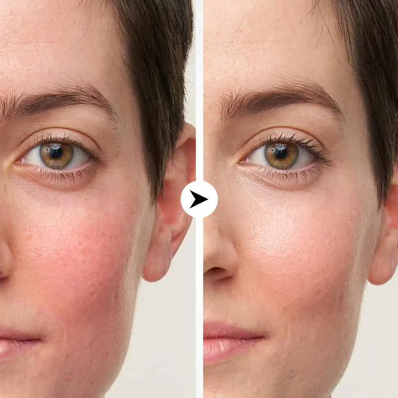 LED Face Mask Light Therapy