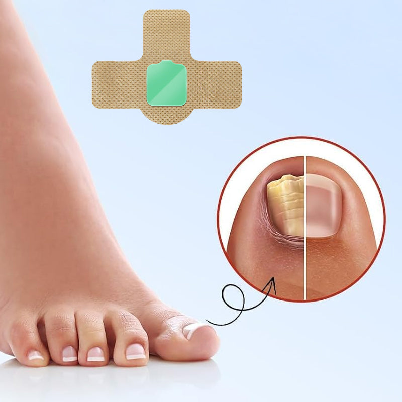 Fungal Nail Patches (21 pcs/box)