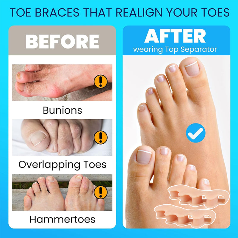 Five-Hole Toe Separators (5 Pairs)
