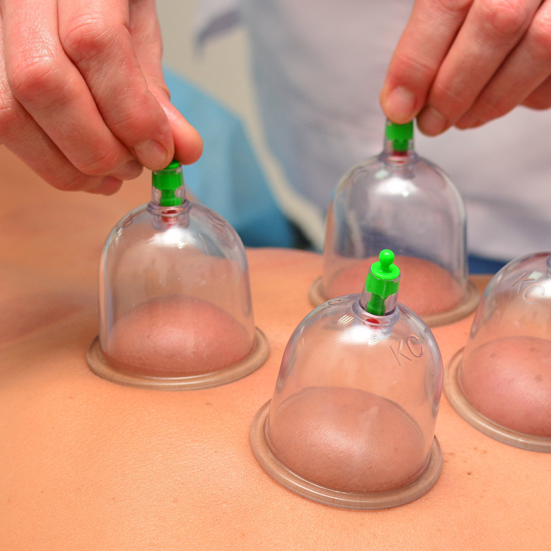Cupping Set For Massage Therapy