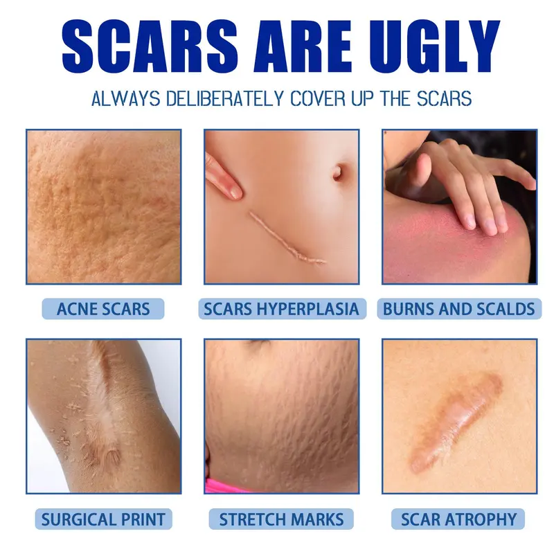 Professional Scar Removal Gel