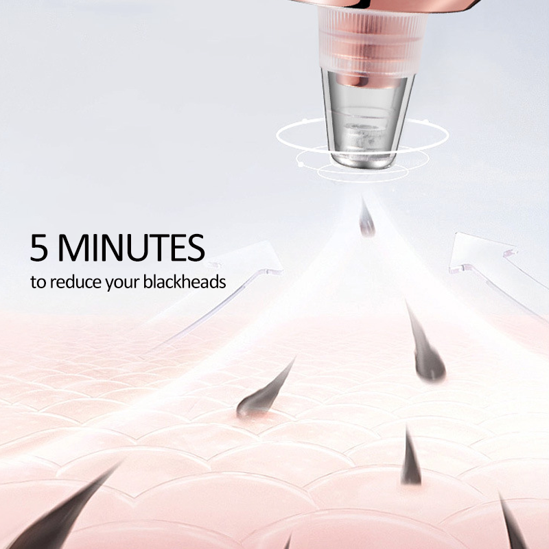 Professional Vacuum Blackhead Remover
