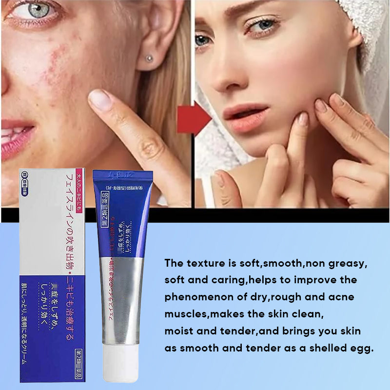 Gentle Antibacterial Acne Cream