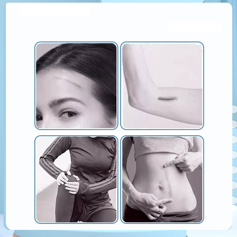 Emergency Wound Closure Strips