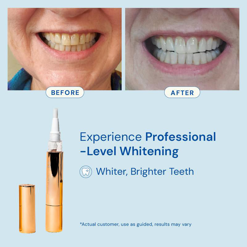 Extra-Strength Teeth Whitening Serum Oral Care