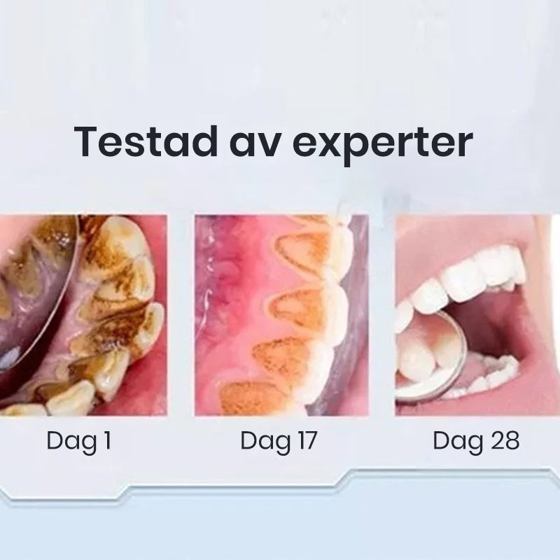 Super Probiotic-6 tandkräm