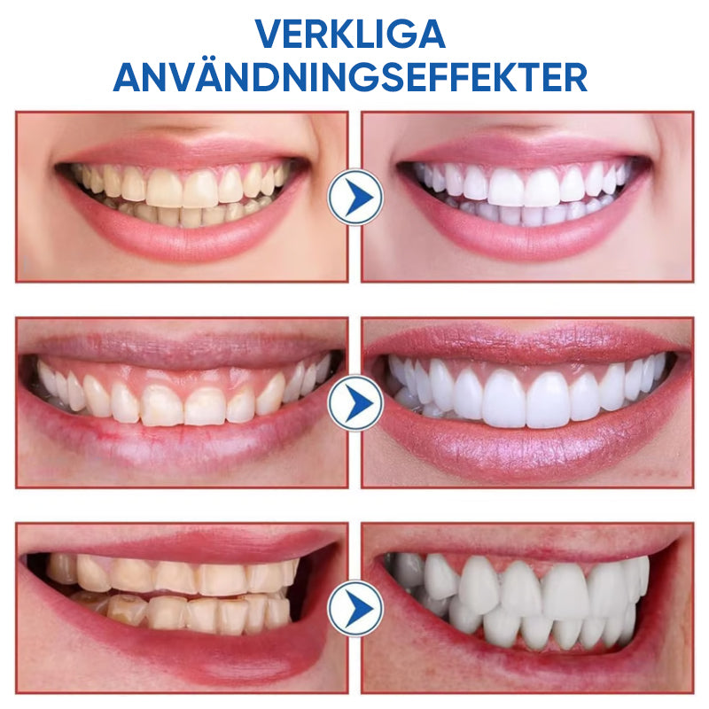 SP10 Probiotisk tandkräm