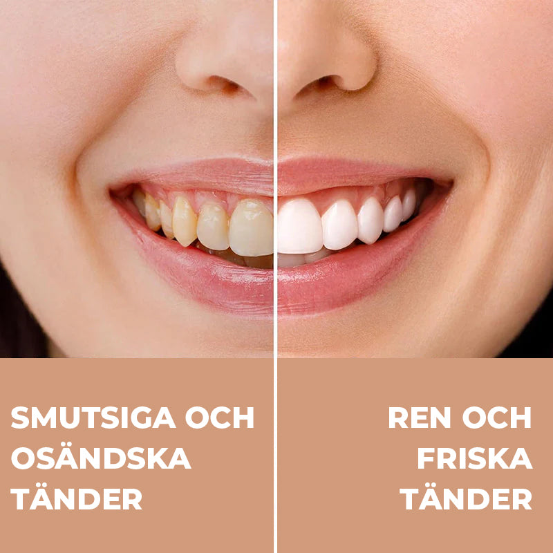 Hydroxyapatit tandkräm