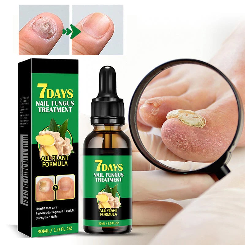 Ingefära nagelbehandling