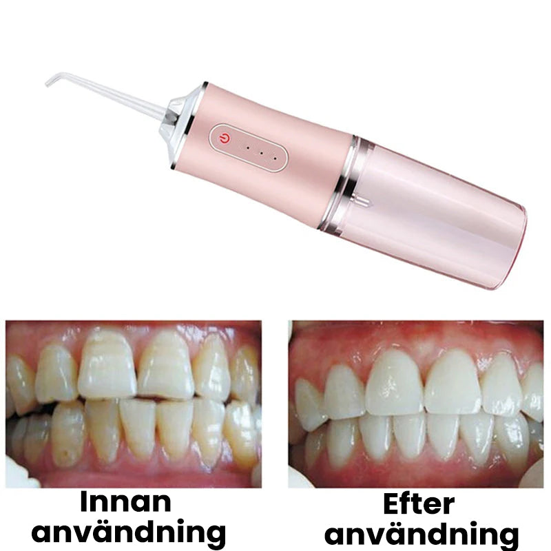 Bärbar tandvattenstråle