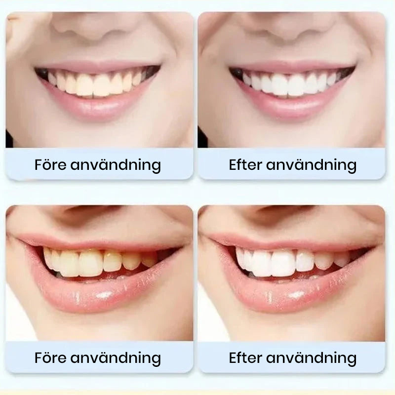 Super Probiotic-6 tandkräm