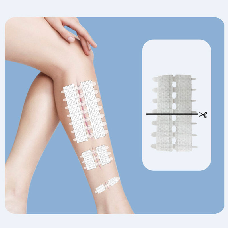 Emergency Wound Closure Strips