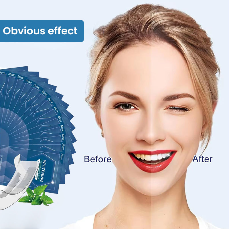 Teeth Whitening Strips