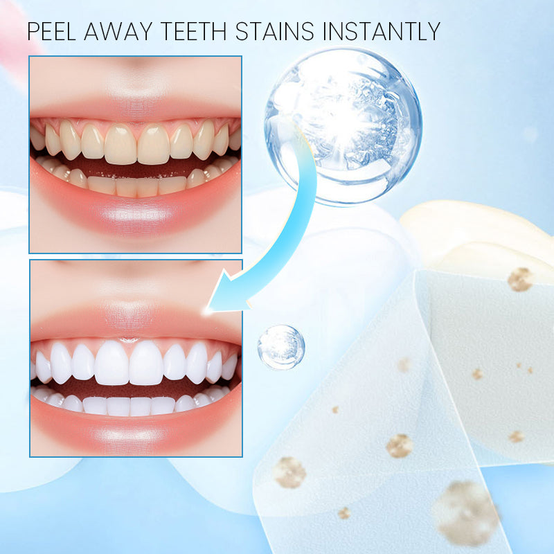 Teeth Whitening Strips 28 Strips (14 Day Treatment)