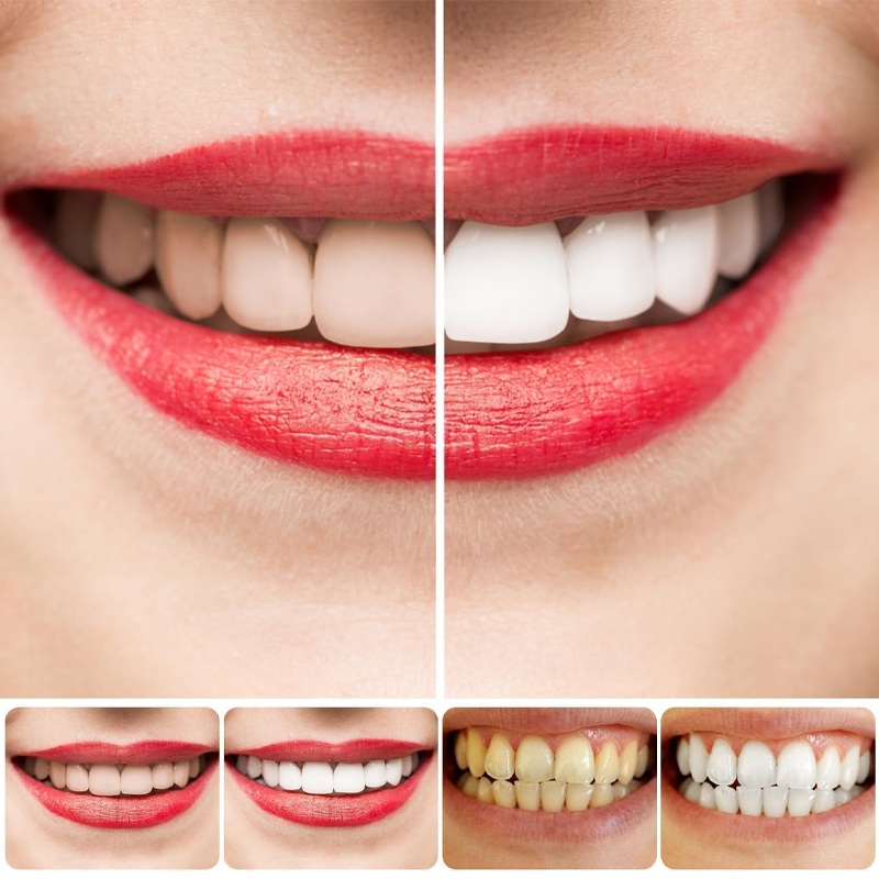 SP10 Probiotisk tandkräm