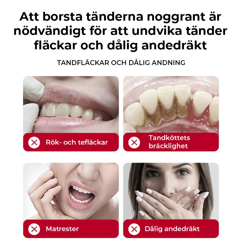 SP-8/SP-10 Probiotisk blekande tandkräm för munhälsa