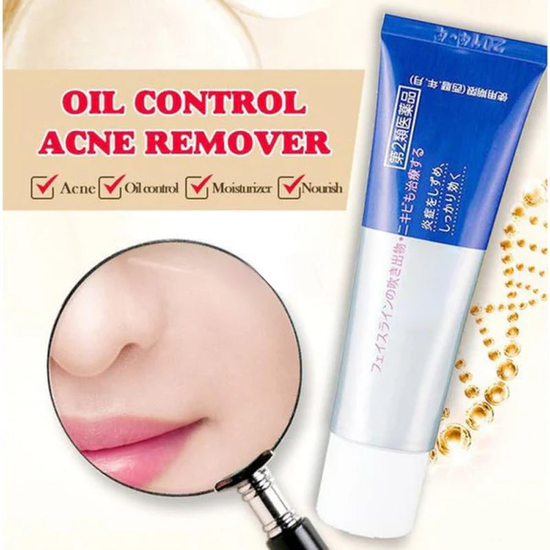 Gentle Antibacterial Acne Cream