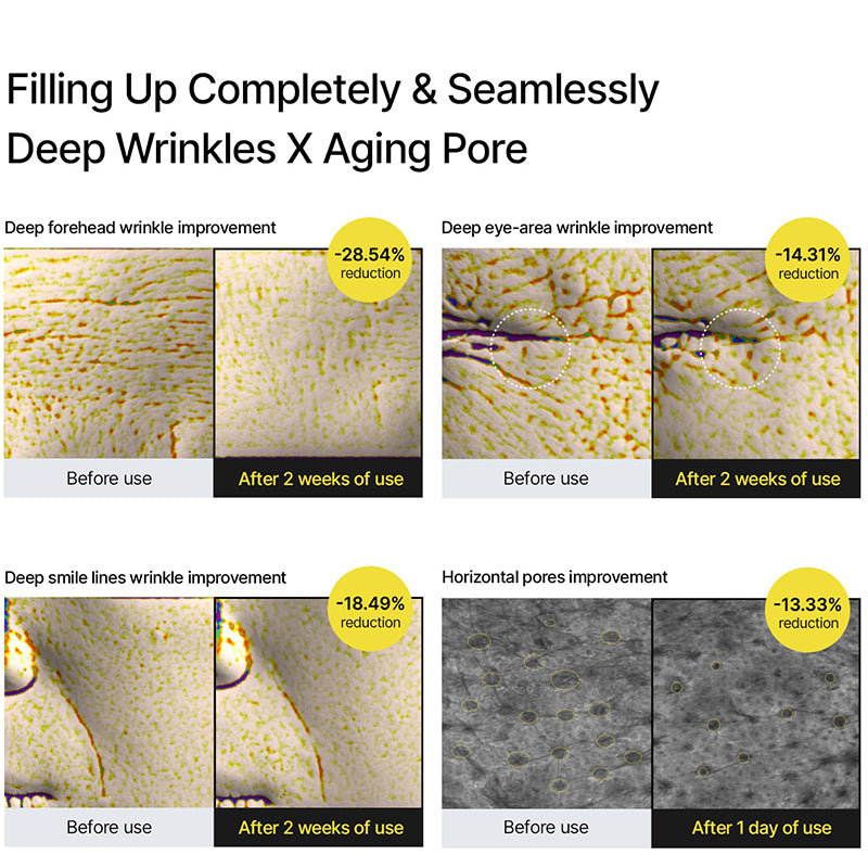 Retinol Firming Set (Eye Cream + Serum)