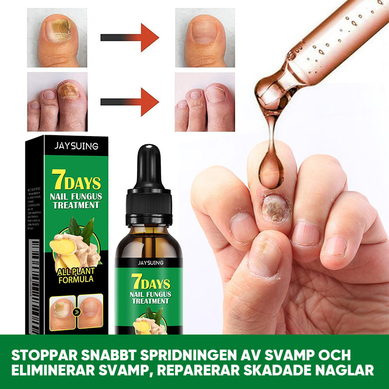 Ingefära nagelbehandling