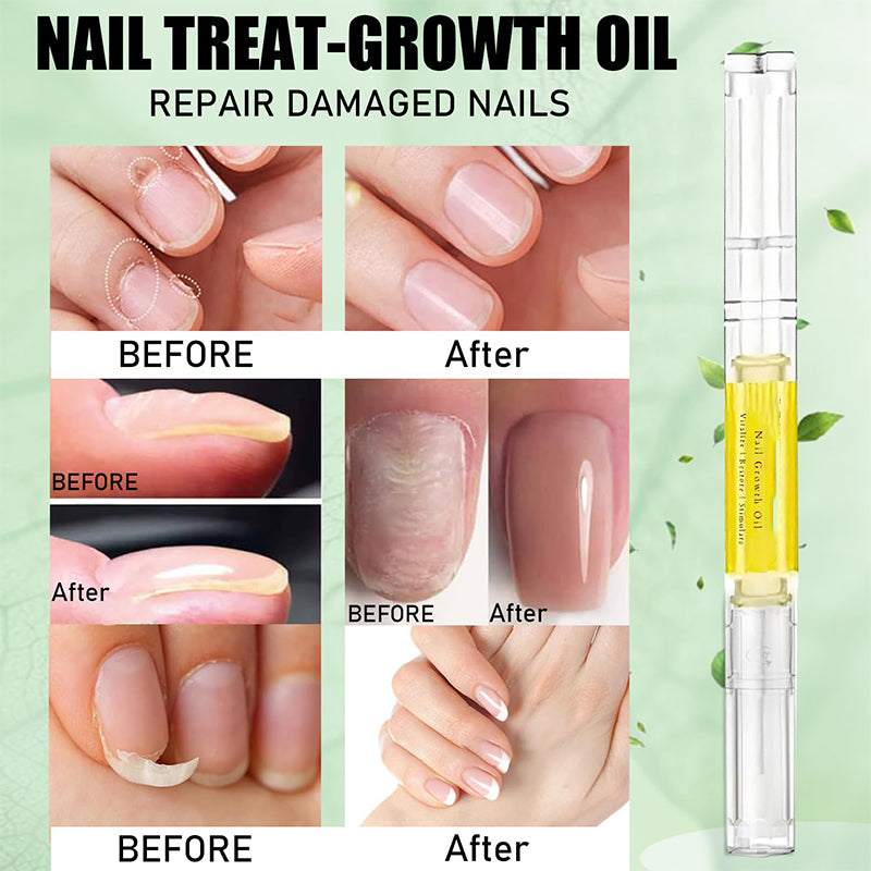 Nail Strengthening & Growth Treatment Oil