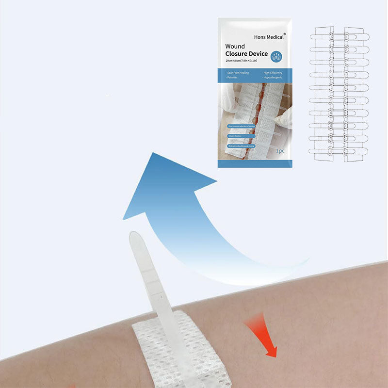 Emergency Wound Closure Strips