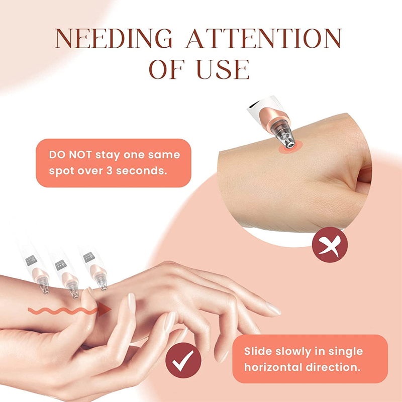 Professional Vacuum Blackhead Remover