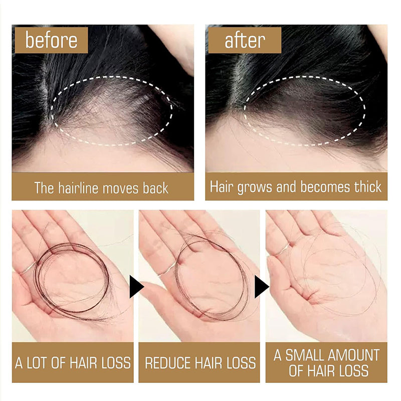 Anti-Hair Fall Hair Loss Shampoo