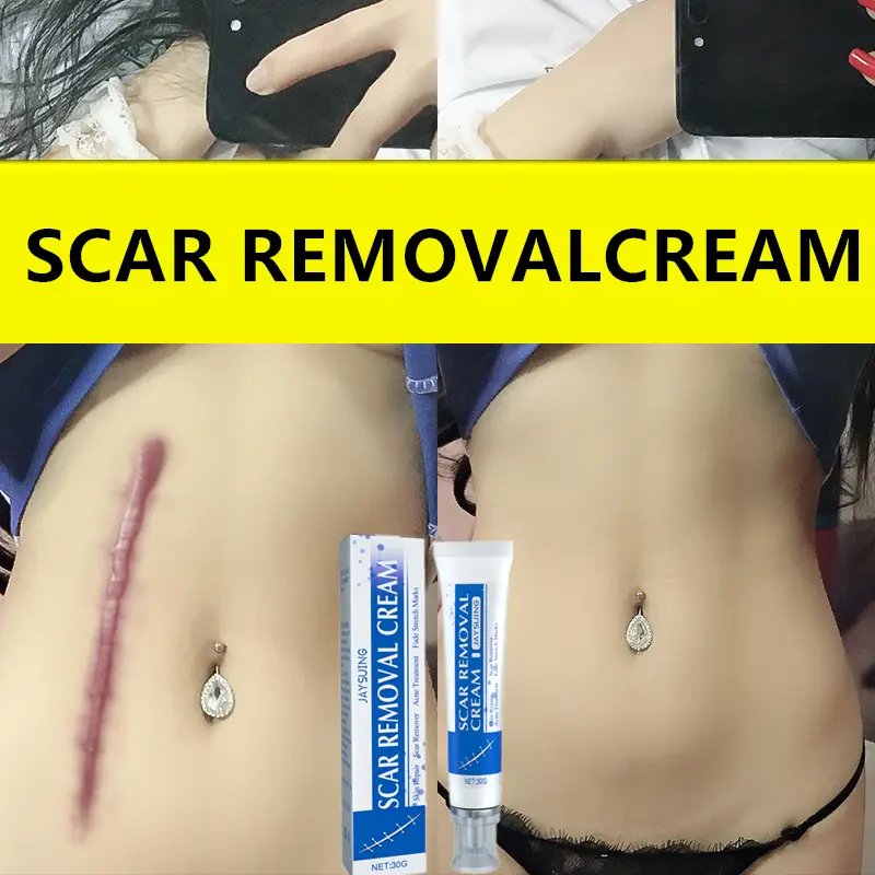Professional Scar Removal Gel