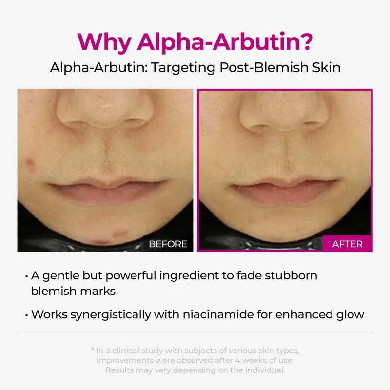 Intensive Discoloration Serum