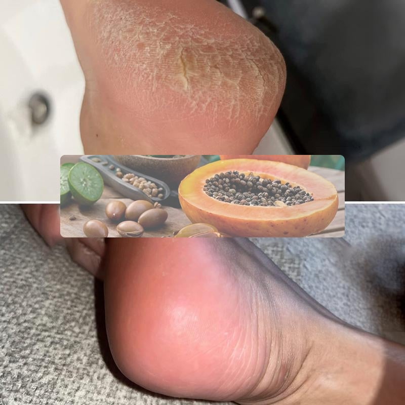 Exfoliating Foot Mask