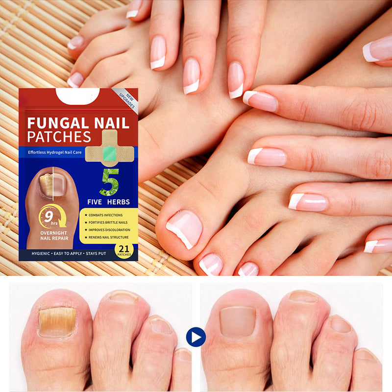 Fungal Nail Patches (21 pcs/box)